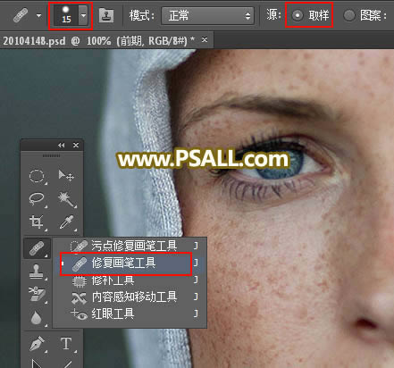 对满脸雀斑人像照片后期磨皮的PS教程