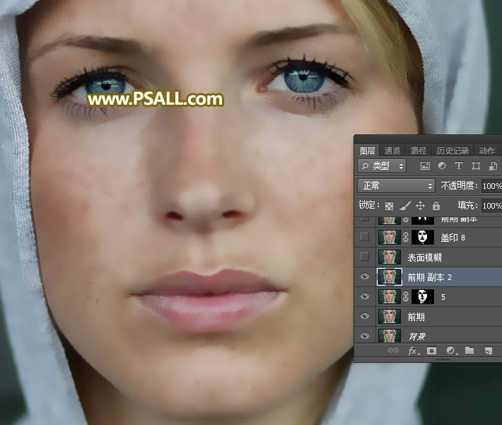 对满脸雀斑人像照片后期磨皮的PS教程